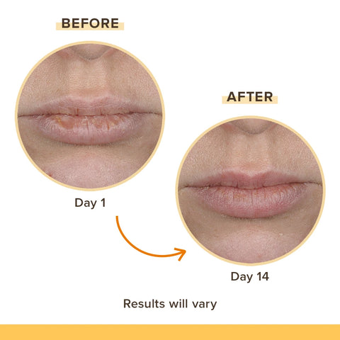 Burt's Bees Lip Balm Rescue 4 Pack